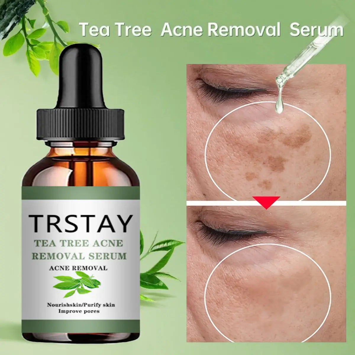 TRSTAY Tea Tree Oil Essence - Fade Spots, Shrink Pores & Brighten Skin
