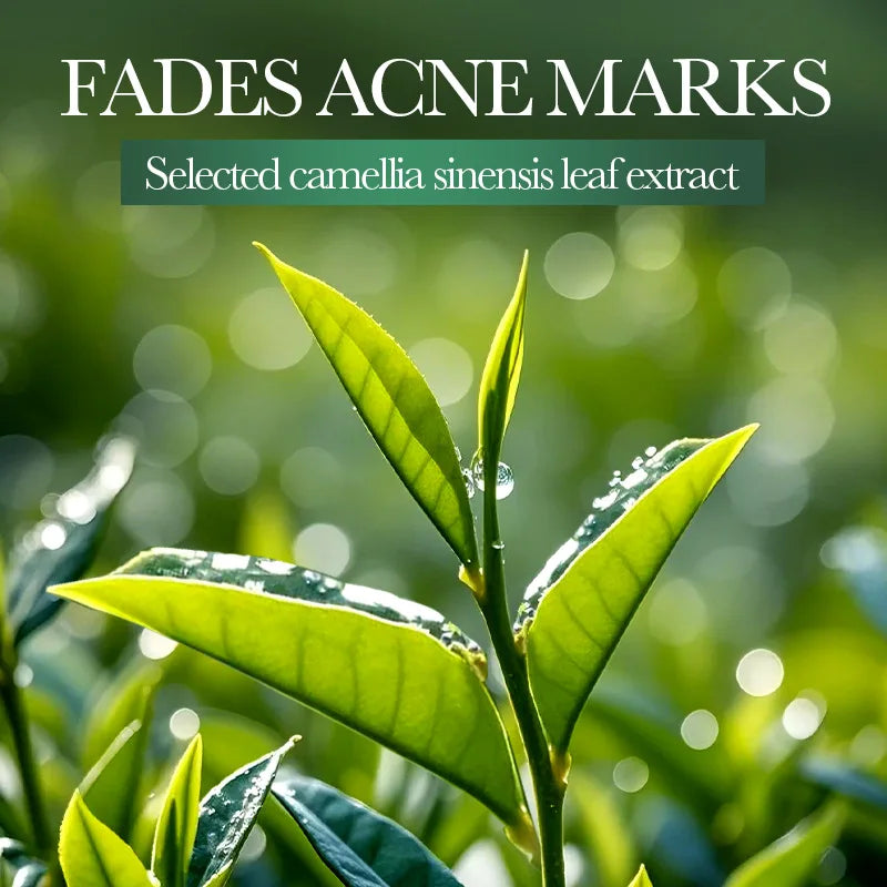 SADOER Salicylic Acid & Niacinamide Face Masks - Anti-Acne & Brightening