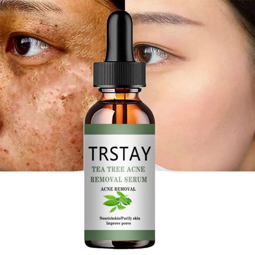 TRSTAY Tea Tree Oil Essence - Fade Spots, Shrink Pores & Brighten Skin