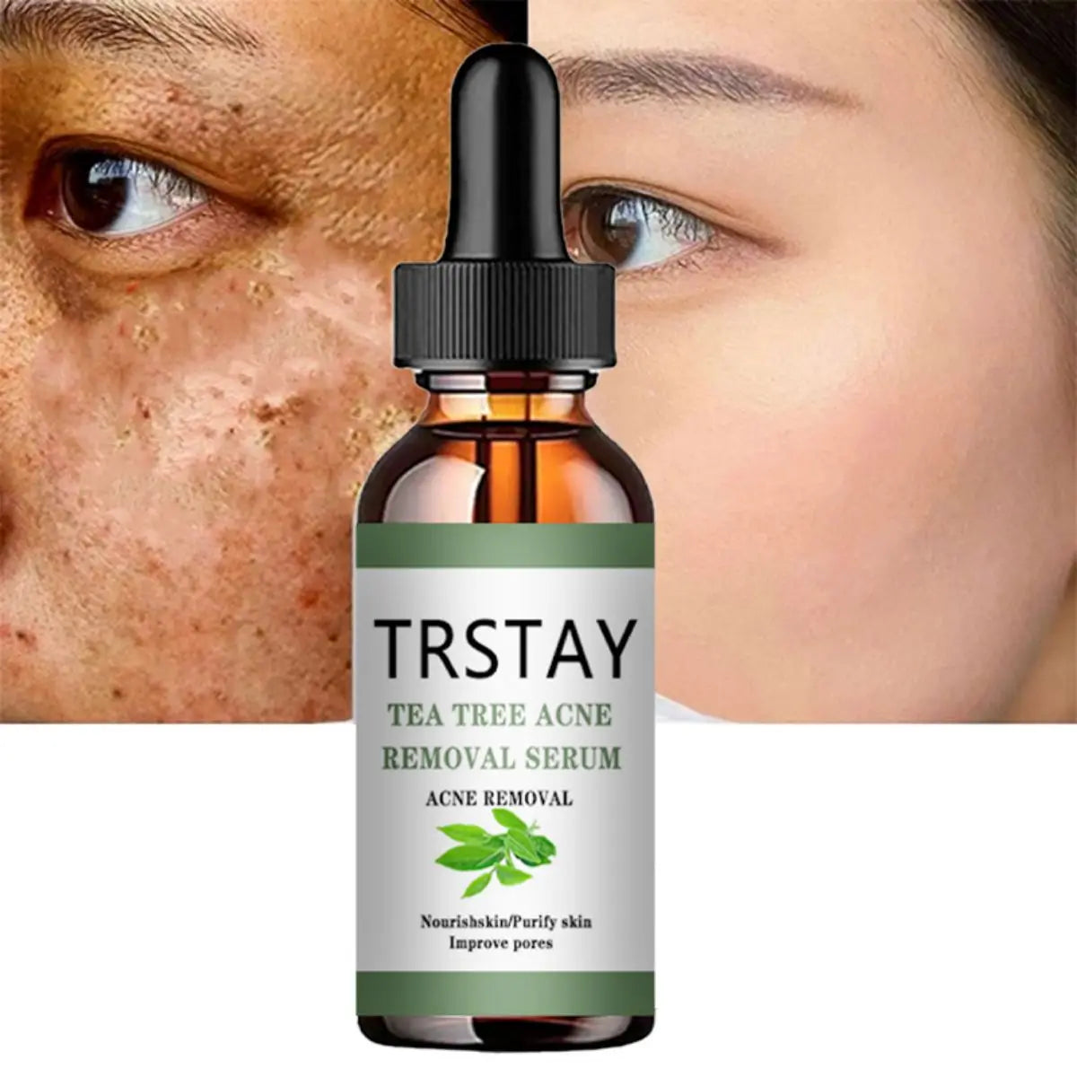 TRSTAY Tea Tree Oil Essence - Fade Spots, Shrink Pores & Brighten Skin