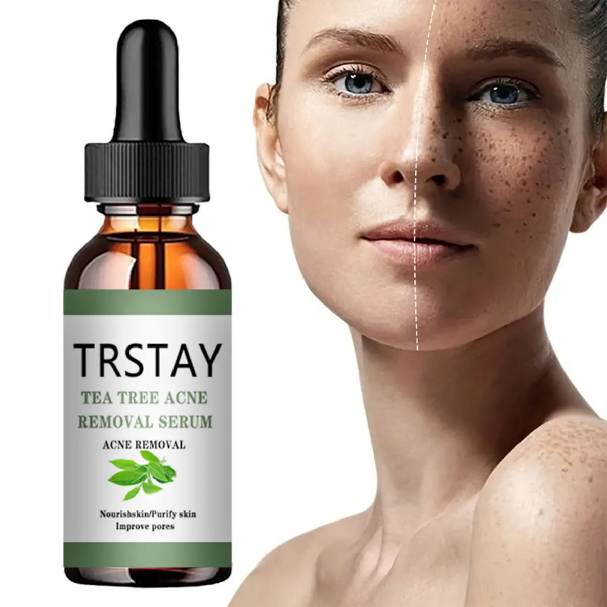 TRSTAY Tea Tree Oil Essence - Fade Spots, Shrink Pores & Brighten Skin